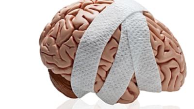 3 Tips to Remember About Concussions 